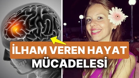 Glioblastoma Mücadelesi! Nadir Görülen Bir Hastalıkla Mücadele Etti Eşinin Sevgisiyle En Zor Anlara Direndi