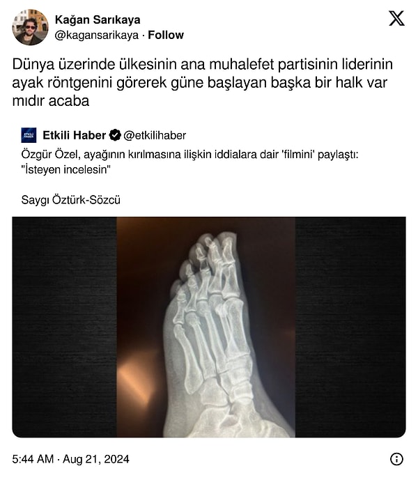 Ayak atmayan kalmadı.