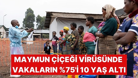 Maymun Çiçeği Virüsünde Vakaların Çoğunluğu Çocuklardan Oluşuyor