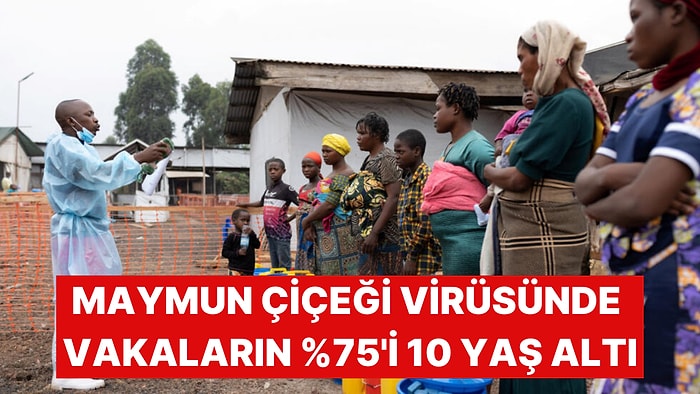 Maymun Çiçeği Virüsünde Vakaların Çoğunluğu Çocuklardan Oluşuyor