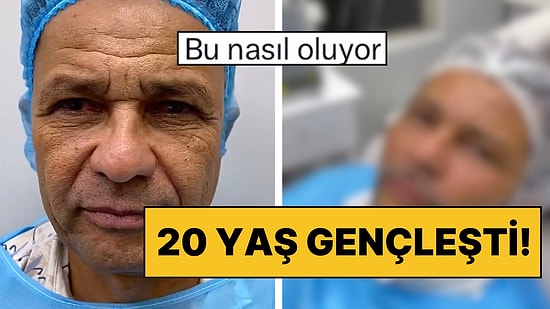 Tüm Yüzüne Yaptırdığı Estetik Operasyonlarla Tanınmaz Halde Gençleşti