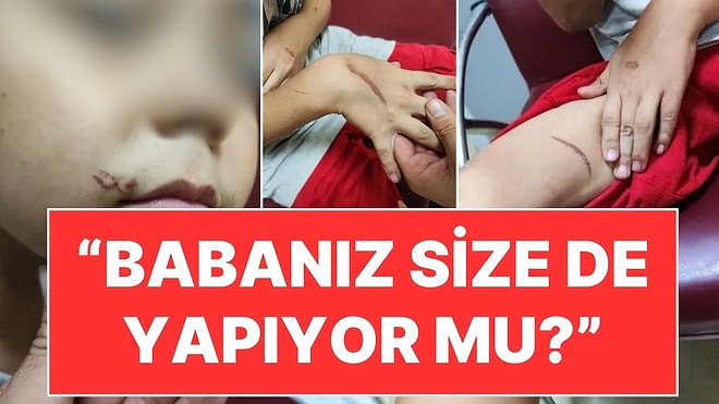 İstanbul'da 8 Yaşındaki Çocuğa Kızgın Tornavida İle İşkence: "Babanız Size de Yapıyor mu?"