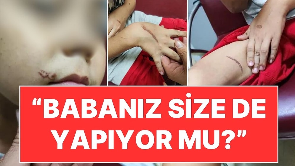 İstanbul'da 8 Yaşındaki Çocuğa Kızgın Tornavida İle İşkence: "Babanız Size de Yapıyor mu?"