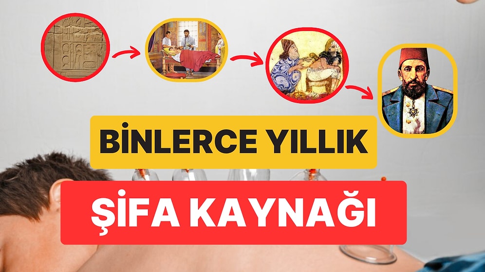 Asırlık Bir Şifa Yöntemi: Hacamatın Tarihi Geçmişini İnceliyoruz