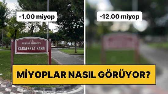 Miyoplar Etrafını Nasıl Görüyor? Bir Göz Doktoru Numara Numara Kıyasladı