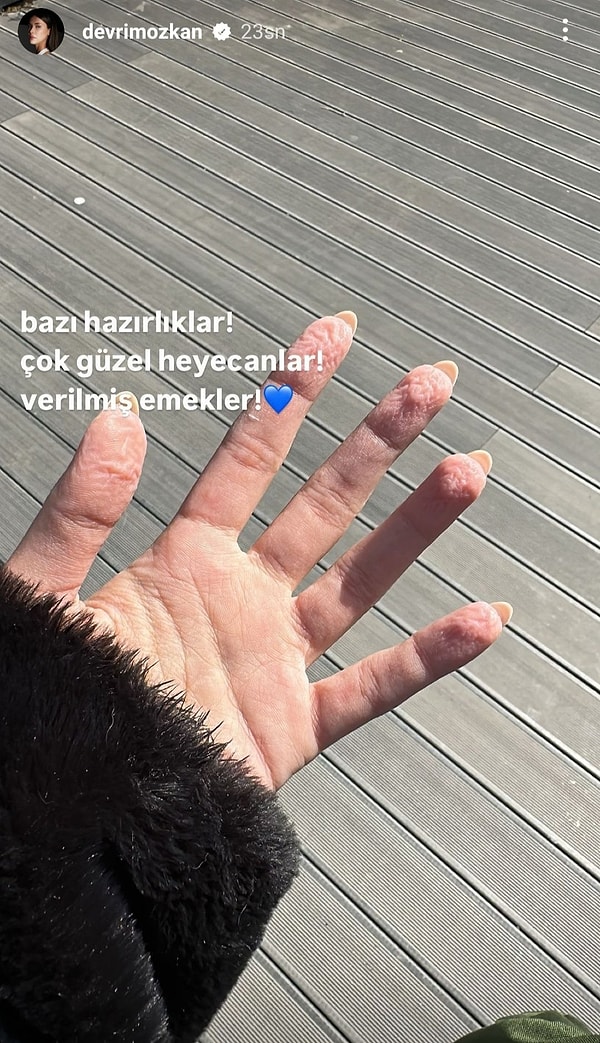 Bonus: Devrim Özkan'dan bir Instagram paylaşımı