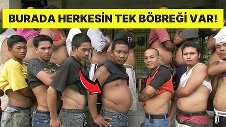 Her Sakininin Sadece Tek Böbreğe Sahip Olduğu Asya Köyü: Hokse