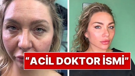 Geçirdiği Estetik Operasyonlarla 20 Yaş Gençleşen Kadının Değişimi Beğenileri Topladı