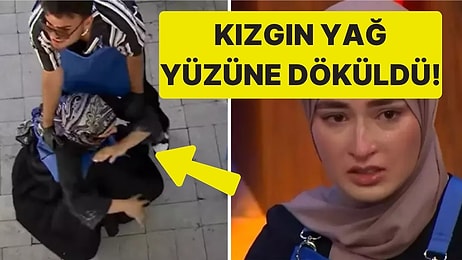 MasterChef'te Beyza'nın Yüzüne Kızgın Yağ Döküldüğü Anlar Yayınlandı