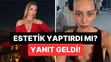 Değişimiyle Şaşkına Çevirmişti: Setlere Dönen Sinem Kobal Estetik İddialarına İlk Kez Cevap Verdi!