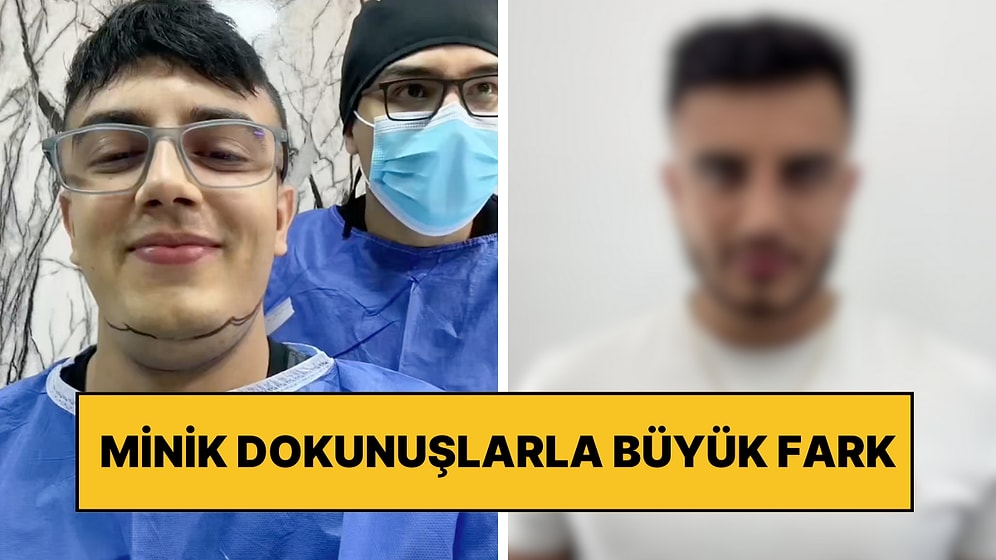 Gıdısını Aldıran Adamın Minik Dokunuşlarla Yaşadığı Değişim Sizleri de Şoke Edecek