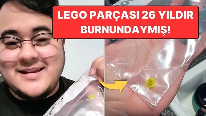 Küçükken Burnuna Kaçırdığı LEGO Parçasını Tam 26 Yıl Sonra Çıkaran Adam