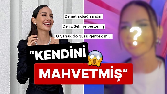 Gün Geçtikçe Başkalaşıyor: Röportaj Veren Yasemin Özilhan'ın Estetikten Geçilmeyen Yüzü Şoka Soktu!