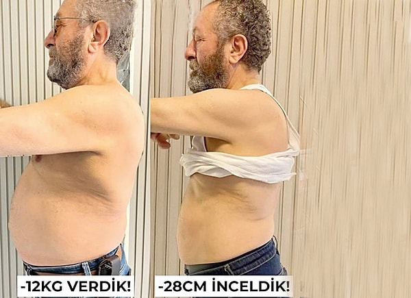 1 ayda tam 12 kilo veren oyuncu şu açıklamada bulundu: "Söylendiği gibi ameliyatla yağ aldırma falan yok. Unu, şekeri kestim, zayıflama makinelerinde mesai harcadım. Doktor kontrolündeki diyetle sıkı bir disipline girdim. Daha sağlıklı hissediyorum artık." İşte oyuncunun son hali 👇