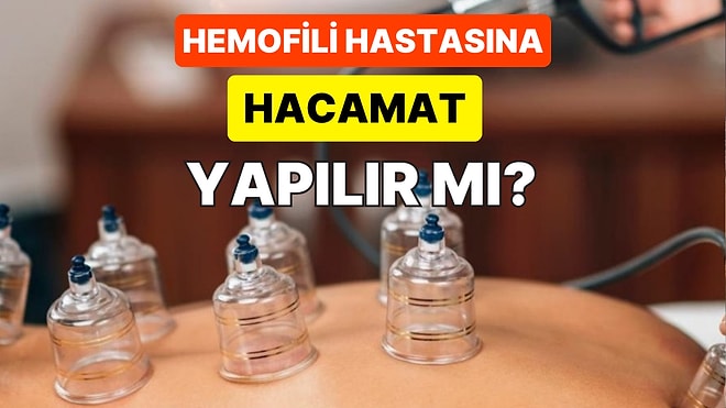 Fitoterapi Uzmanının Hemofili Hastalarına Hacamat Önermesi Sosyal Medyada Ortalığı Karıştırdı