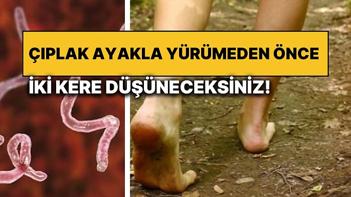 Hoş Geldin Yeni Fobi Bebek: Çıplak Ayakla Toprakta Yürürken “Kancalı Kurt”lar Vücudunuza Girebilir