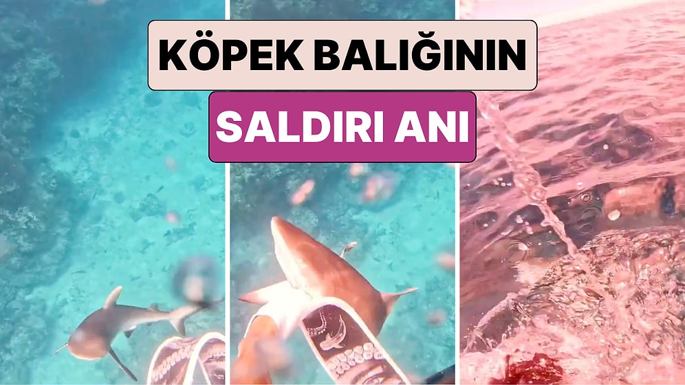 Öleceğini Düşünmüş: Sporcu Wade Papenus Kendisine Köpek Balığı Saldırdığı Anları Paylaştı