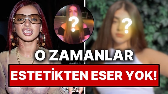 Alizade'nin Estetiğe Girişmeden Önceki Yıllara Ait Çocukluk Fotoğrafları Görenleri Şoklardan Şoklara Soktu!