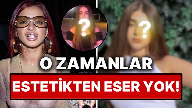 Alizade'nin Estetiğe Girişmeden Önceki Yıllara Ait Çocukluk Fotoğrafları Görenleri Şoklardan Şoklara Soktu!