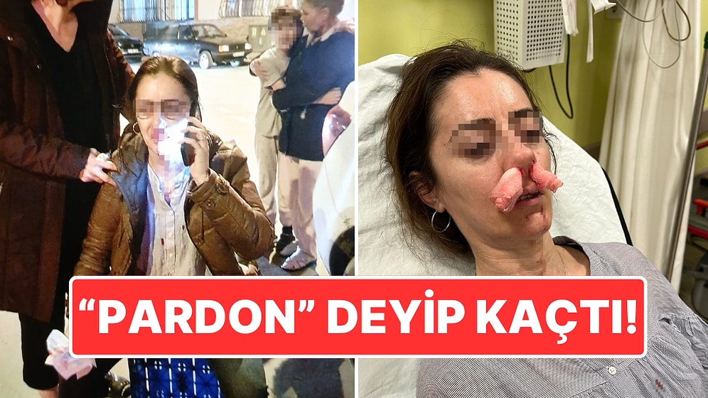 "Pardon": Kocasının Sevgilisi Zannettiği Kadına Saldırdı, Olay Yerinden Kaçtı