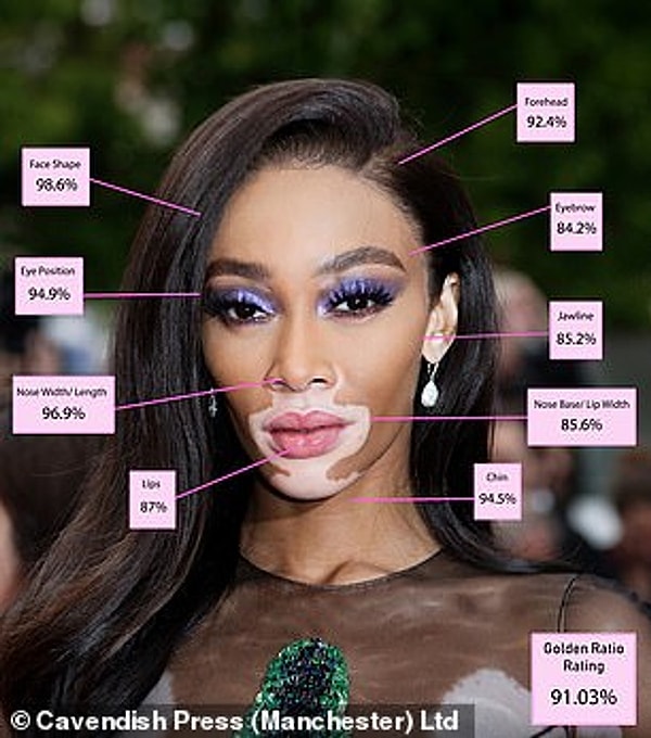 5. Winnie Harlow – 91.03%