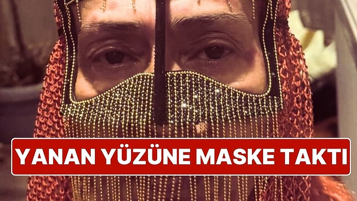 Saç Boyası Nedeniyle Yüzünde Yanıklar Oluşan Yıldız Tilbe, Taktığı Taşlı Maske ile Dikkatleri Üzerine Çekti