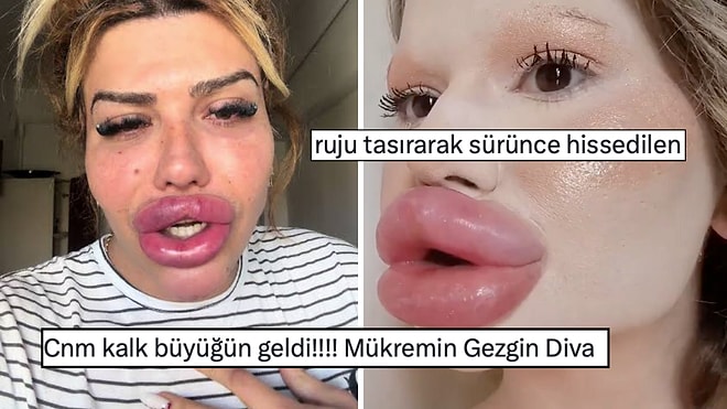 32 Ameliyat Sonrası 'Dünyanın En Büyük Dudaklı Kadını' Olan Andrea Ivanova X'te Goygoyseverlere Malzeme Oldu!