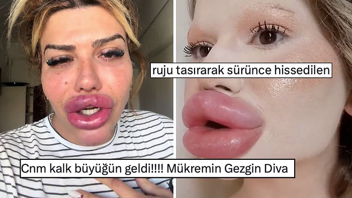 32 Ameliyat Sonrası 'Dünyanın En Büyük Dudaklı Kadını' Olan Andrea Ivanova X'te Goygoyseverlere Malzeme Oldu!