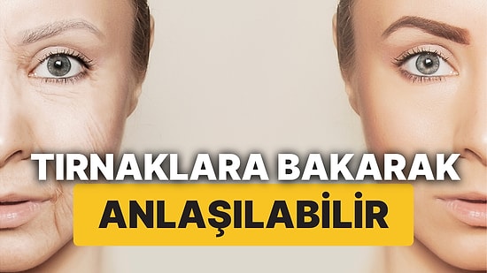 Tırnaklarınız Hızlı mı Uzar Yavaş mı? Tırnaklar Ne Kadar Yaşlandığınızın ve Yaşayacağınızın Habercisi Olabilir