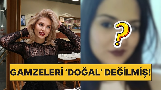 Kısmetse Olur'un Fenomen Yarışmacısı Aybüke Çangal'ın Estetiksiz Hali Ortaya Çıktı!