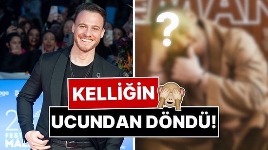 Kelliğin Ucundan Döndü: Saç Ektirdiği Ortaya Çıkan Kerem Bürsin'den Yeni İmajıyla Yeni Pozlar!