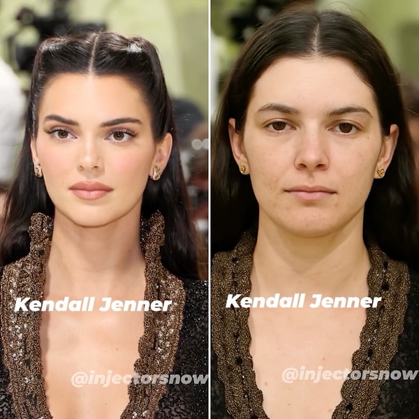 Kendall Jenner
