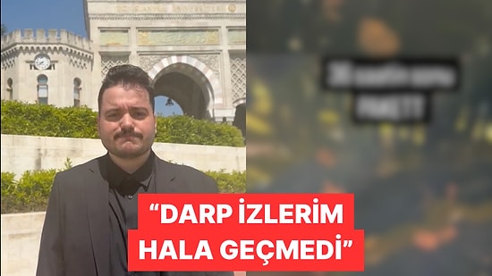 Saraçhane Protestocusu Eren Üner Gözaltı Sırasında Yaşadıklarını Anlattı
