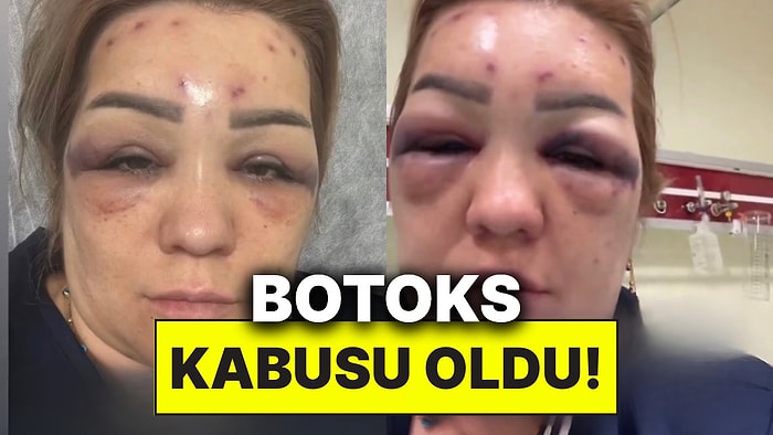 Güzellik Merkezinde Botoks Yaptıran Kadın Soluğu Hastanede Aldı