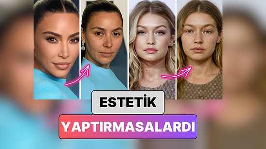 Bir Doktor Yapay Zeka ile Ünlü İsimlerin Enjeksiyonlara Başvurmasalardı Nasıl Görüneceklerini Gösterdi