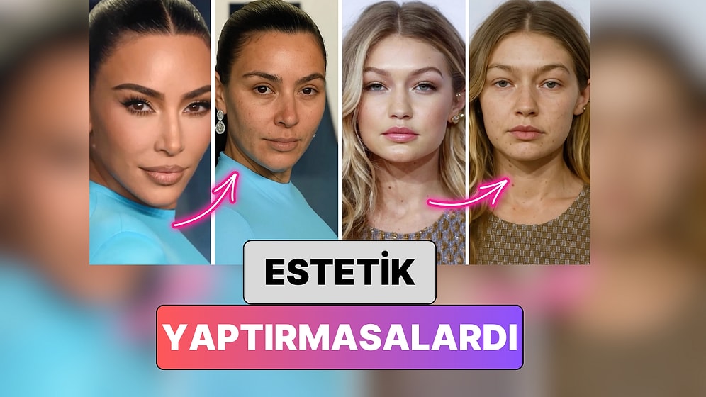 Bir Doktor Yapay Zeka ile Ünlü İsimlerin Enjeksiyonlara Başvurmasalardı Nasıl Görüneceklerini Gösterdi