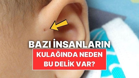 Bazı İnsanların Kulaklarının Üzerinde Neden Delik Var?
