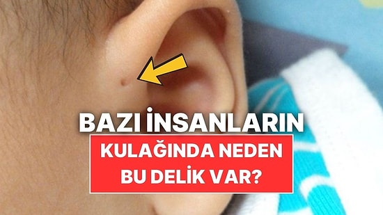Bazı İnsanların Kulaklarının Üzerinde Neden Delik Var?
