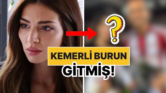 Kemerli Burun Gitmiş: Melisa Aslı Pamuk'nun Doğum Sonrası Yüzündeki Değişim Olay Oldu!