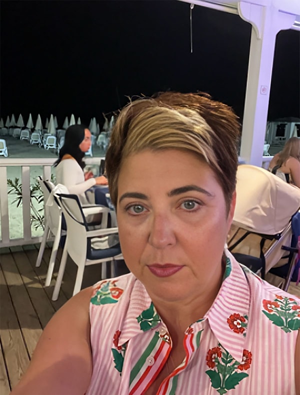 Jayne, "Düşen göz kapakları ve göz altı morluklarıyla yıllardır savaşıyorum" diyor. Görseli