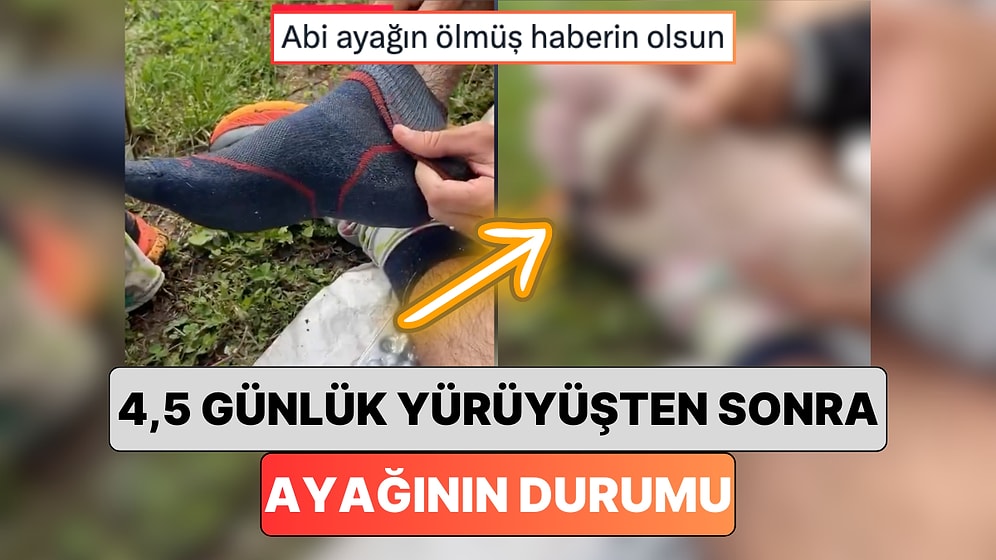 Yaptığı Uzun Yürüyüşlerle Bilinen Ekstrem Sporcu 4,5 Günlük Yürüyüşünün Ardından Ayağının Halini Paylaştı