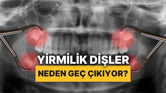 Yirmilik Dişler Neden Çocukken Değil de Yetişkinlikte Çıkıyor?