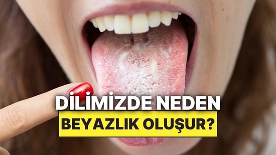 Dilimizin Arka Kısımlarında Oluşan Bu Beyazlığın Sebebi Nedir?
