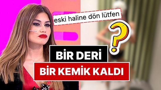 Cezaevinden Anoreksiya Hastalığı Nedeniyle Tahliye Edilen Nihal Candan’ın Son Hali Korkuttu