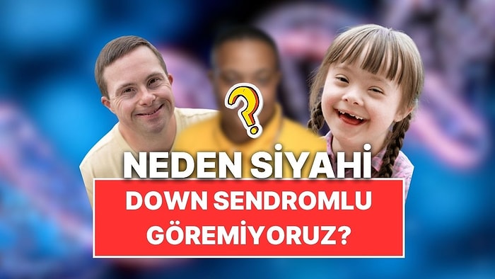 Neden Siyahi Down Sendromlu Bireyleri Pek Göremiyoruz?