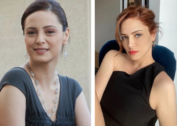 Çene ve Çene Hattı