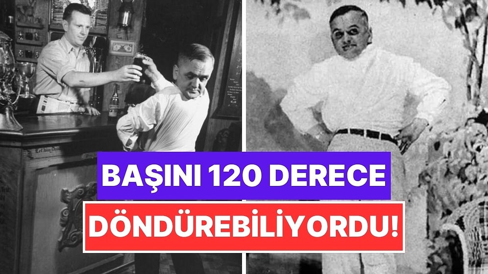 Kafasını 120 Derece Geriye Döndürebilen "Baykuş Adam" Martin Laurello’nun Tuhaf Hikayesi