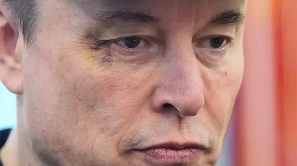 Teknoloji milyarderi Elon Musk, ABD Başkanı Donald Trump ile Beyaz Saray’daki veda basın toplantısına sağ gözü morarmış şekilde katıldı.