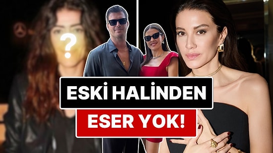 Kıvanç Tatlıtuğ'un Eşi Başak Dizer'in Yıllar İçerisinde Giderek Gençleşmesi Kullanıcıları İkiye Böldü!