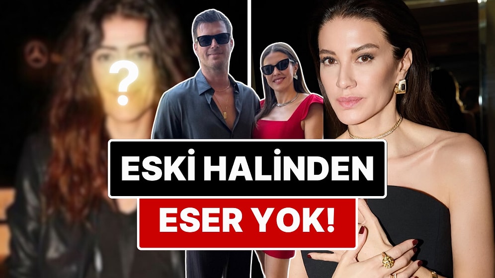 Kıvanç Tatlıtuğ'un Eşi Başak Dizer'in Yıllar İçerisinde Giderek Gençleşmesi Kullanıcıları İkiye Böldü!